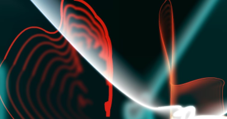 Абдул Ферезман | Гянджа