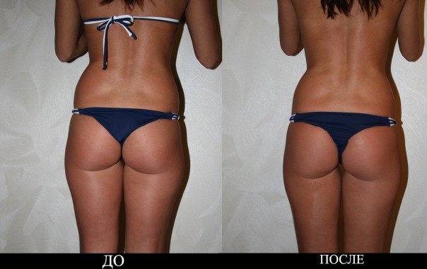 №89, Любовь Κарасева, 38 лет, Калининград №89, Любовь Κарасева, 38 лет, Калининград